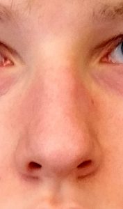 Nase von vorn 2